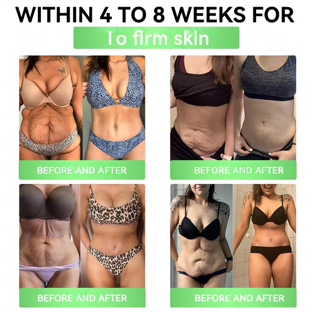 🇮🇪𝑶𝒏𝒍𝒊𝒏𝒆 𝑷𝒉𝒂𝒓𝒎𝒂𝒄𝒚👩‍⚕️ | 𝐏𝐄𝐀𝐊𝐀® 𝑮𝑳𝑷-𝟏 + 𝑺𝑮𝑳𝑻-𝟐𝒊 𝗦𝗹𝗶𝗺 & 𝑯𝒆𝒂𝒍𝒕𝒉 𝑶𝒓𝒂𝒍 𝑺𝒐𝒍𝒖𝒕𝒊𝒐𝒏 (𝑂𝑛𝑐𝑒 𝑎 𝑑𝑎𝑦, 𝑣𝑖𝑠𝑖𝑏𝑙𝑒 𝑟𝑒𝑠𝑢𝑙𝑡𝑠 𝑖𝑛 7 𝑑𝑎𝑦𝑠) ✅𝗦𝘂𝗽𝗽𝗼𝗿𝘁𝘀 𝗼𝗯𝗲𝘀𝗶𝘁𝘆, 𝗰𝗮𝗿𝗱𝗶𝗼𝘃𝗮𝘀𝗰𝘂𝗹𝗮𝗿 𝗵𝗲𝗮𝗹𝘁𝗵, 𝗱𝗶𝗮𝗯𝗲𝘁𝗲𝘀, 𝘀𝗹𝗲𝗲𝗽 𝗮𝗽𝗻𝗲𝗮, 𝗴𝘂𝘁 𝗵𝗲𝗮𝗹𝘁𝗵, 𝗷𝗼𝗶𝗻𝘁 𝗶𝘀𝘀𝘂𝗲𝘀, 𝐰𝐡𝐢𝐥𝐞 𝐚𝐥𝐬𝐨 𝐟𝐢𝐫𝐦𝐢𝐧𝐠 𝐭𝐡𝐞 𝐬𝐤𝐢𝐧 𝐚𝐧𝐝 𝐛𝐨𝐨𝐬𝐭𝐢𝐧𝐠 𝐞𝐧𝐞𝐫𝐠𝐲