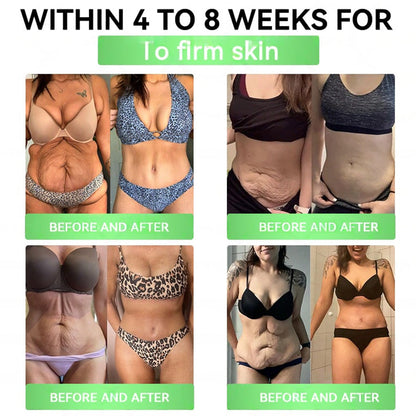 🇮🇪𝑶𝒏𝒍𝒊𝒏𝒆 𝑷𝒉𝒂𝒓𝒎𝒂𝒄𝒚👩‍⚕️ | 𝐏𝐄𝐀𝐊𝐀® 𝑮𝑳𝑷-𝟏 + 𝑺𝑮𝑳𝑻-𝟐𝒊 𝗦𝗹𝗶𝗺 & 𝑯𝒆𝒂𝒍𝒕𝒉 𝑶𝒓𝒂𝒍 𝑺𝒐𝒍𝒖𝒕𝒊𝒐𝒏 (𝑂𝑛𝑐𝑒 𝑎 𝑑𝑎𝑦, 𝑣𝑖𝑠𝑖𝑏𝑙𝑒 𝑟𝑒𝑠𝑢𝑙𝑡𝑠 𝑖𝑛 7 𝑑𝑎𝑦𝑠) ✅𝗦𝘂𝗽𝗽𝗼𝗿𝘁𝘀 𝗼𝗯𝗲𝘀𝗶𝘁𝘆, 𝗰𝗮𝗿𝗱𝗶𝗼𝘃𝗮𝘀𝗰𝘂𝗹𝗮𝗿 𝗵𝗲𝗮𝗹𝘁𝗵, 𝗱𝗶𝗮𝗯𝗲𝘁𝗲𝘀, 𝘀𝗹𝗲𝗲𝗽 𝗮𝗽𝗻𝗲𝗮, 𝗴𝘂𝘁 𝗵𝗲𝗮𝗹𝘁𝗵, 𝗷𝗼𝗶𝗻𝘁 𝗶𝘀𝘀𝘂𝗲𝘀, 𝐰𝐡𝐢𝐥𝐞 𝐚𝐥𝐬𝐨 𝐟𝐢𝐫𝐦𝐢𝐧𝐠 𝐭𝐡𝐞 𝐬𝐤𝐢𝐧 𝐚𝐧𝐝 𝐛𝐨𝐨𝐬𝐭𝐢𝐧𝐠 𝐞𝐧𝐞𝐫𝐠𝐲