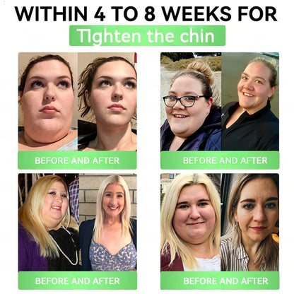 🇮🇪𝑶𝒏𝒍𝒊𝒏𝒆 𝑷𝒉𝒂𝒓𝒎𝒂𝒄𝒚👩‍⚕️ | 𝐏𝐄𝐀𝐊𝐀® 𝑮𝑳𝑷-𝟏 + 𝑺𝑮𝑳𝑻-𝟐𝒊 𝗦𝗹𝗶𝗺 & 𝑯𝒆𝒂𝒍𝒕𝒉 𝑶𝒓𝒂𝒍 𝑺𝒐𝒍𝒖𝒕𝒊𝒐𝒏 (𝑂𝑛𝑐𝑒 𝑎 𝑑𝑎𝑦, 𝑣𝑖𝑠𝑖𝑏𝑙𝑒 𝑟𝑒𝑠𝑢𝑙𝑡𝑠 𝑖𝑛 7 𝑑𝑎𝑦𝑠) ✅𝗦𝘂𝗽𝗽𝗼𝗿𝘁𝘀 𝗼𝗯𝗲𝘀𝗶𝘁𝘆, 𝗰𝗮𝗿𝗱𝗶𝗼𝘃𝗮𝘀𝗰𝘂𝗹𝗮𝗿 𝗵𝗲𝗮𝗹𝘁𝗵, 𝗱𝗶𝗮𝗯𝗲𝘁𝗲𝘀, 𝘀𝗹𝗲𝗲𝗽 𝗮𝗽𝗻𝗲𝗮, 𝗴𝘂𝘁 𝗵𝗲𝗮𝗹𝘁𝗵, 𝗷𝗼𝗶𝗻𝘁 𝗶𝘀𝘀𝘂𝗲𝘀, 𝐰𝐡𝐢𝐥𝐞 𝐚𝐥𝐬𝐨 𝐟𝐢𝐫𝐦𝐢𝐧𝐠 𝐭𝐡𝐞 𝐬𝐤𝐢𝐧 𝐚𝐧𝐝 𝐛𝐨𝐨𝐬𝐭𝐢𝐧𝐠 𝐞𝐧𝐞𝐫𝐠𝐲